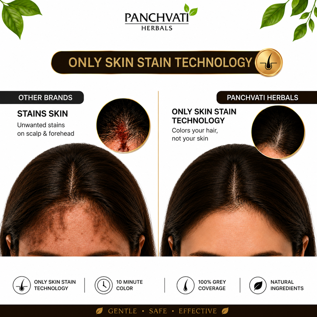 Fruit Vinegar Brown Hair Color Gel for Men & Women | 100% Grey Coverage | No Skin Stains | Ammonia Free | Long Lasting Natural Brown Color | 10 Minute Hair Color | 200ml x 2