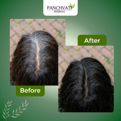 Rixo Black Hair Color Shampoo | Guaranteed No Stain On Skin | No Ammonia  | 100% Grey Coverage | Hair Color In 10 Minutes | 25ml × 10 Pouch= 250 ml