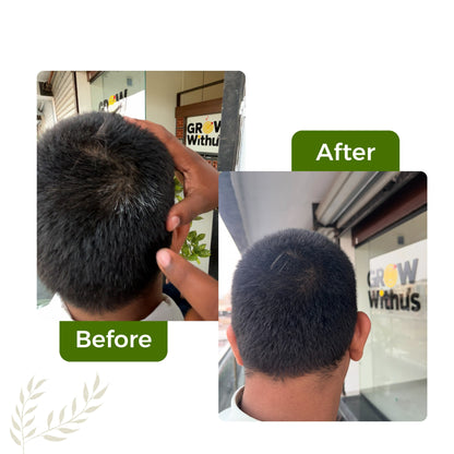 Rixo Black Hair Color Shampoo | Guaranteed No Stain On Skin | No Ammonia  | 100% Grey Coverage | Hair Color In 10 Minutes | 25ml × 10 Pouch= 250 ml