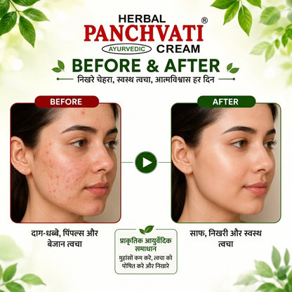 Herbal Panchvati Ayurvedic Face Cream-Glowing Skin for Men & Women (Pack Of 2)